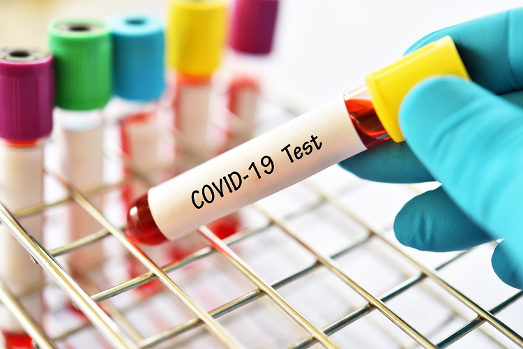 duvidas frequentes sobre o novo coronavirus e seus termos