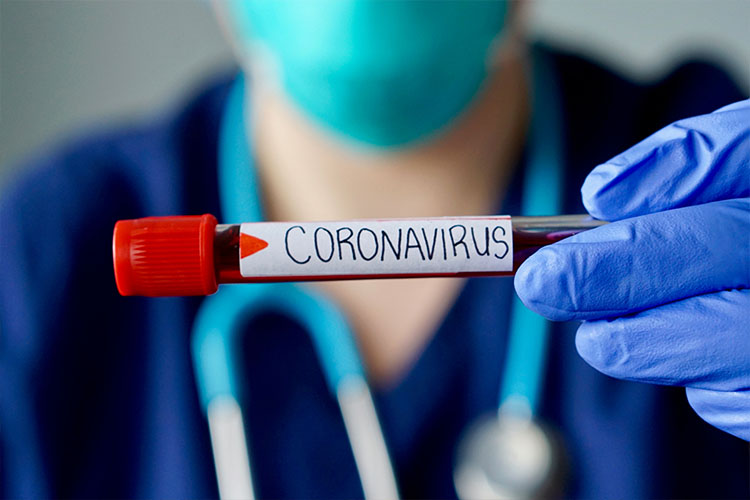 duvidas frequentes sobre o novo coronavirus